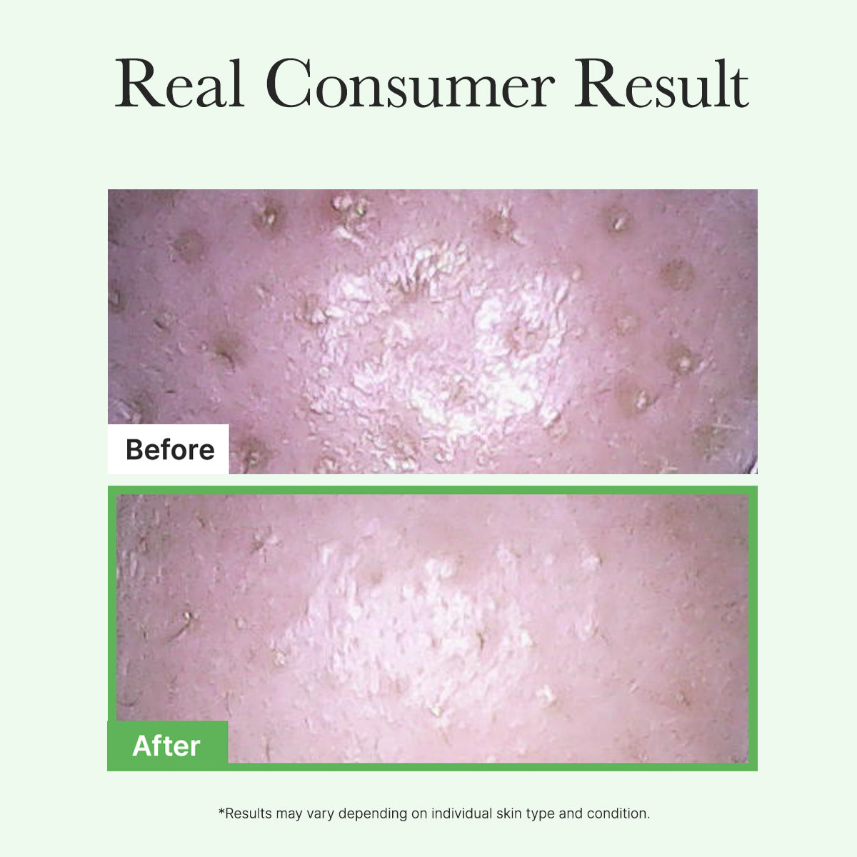 Pore Melt Mochi Makeup-Removing Cleansing Oil, Non-Comedogenic, Acne-Safe, Rice Amino Acids HD, Vitamin E, Cica, & Ceramide, 6.76 fl oz