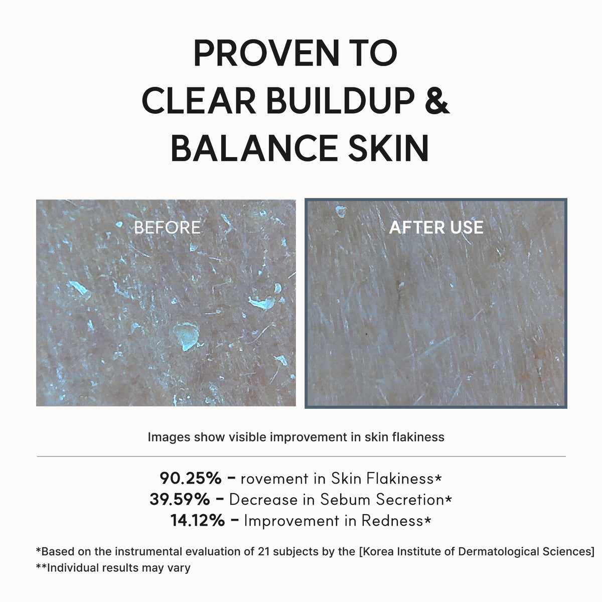 Eraser Shot clinical before-and-after images: 90.25% improvement in skin flakiness, 39.59% less sebum and 14.12% improvement in redness.
