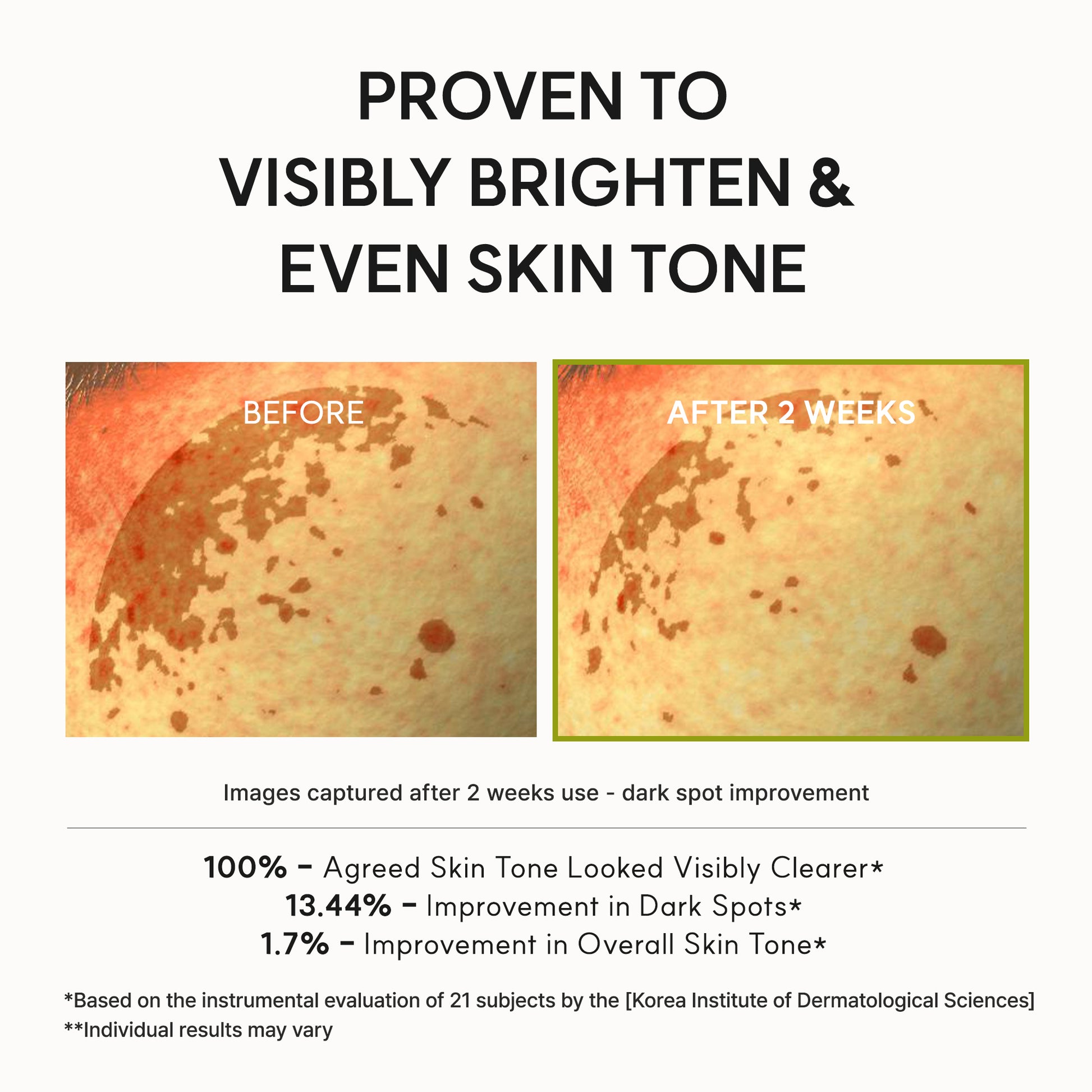 Arencia Vitamin C Booster Shot for Bright, Healthy Skin Glow Arencia Vitamin C Booster Shot for Bright, Healthy Skin Glow
