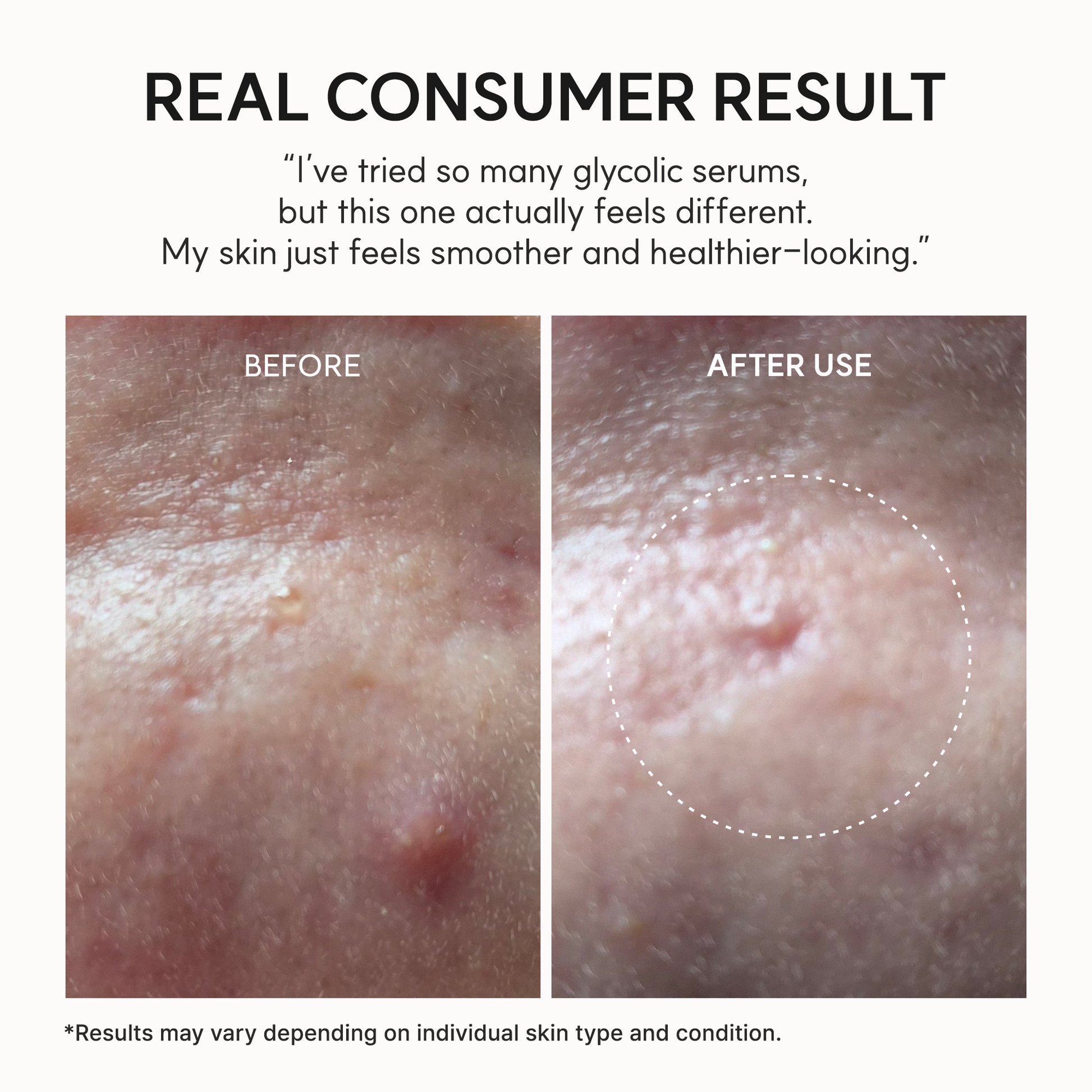 Eraser Shot Glycolic Acid Booster, Daily Clarifying Multi-Acid Formula for Smoother, Clear-Looking Skin, 1.01 fl. oz.