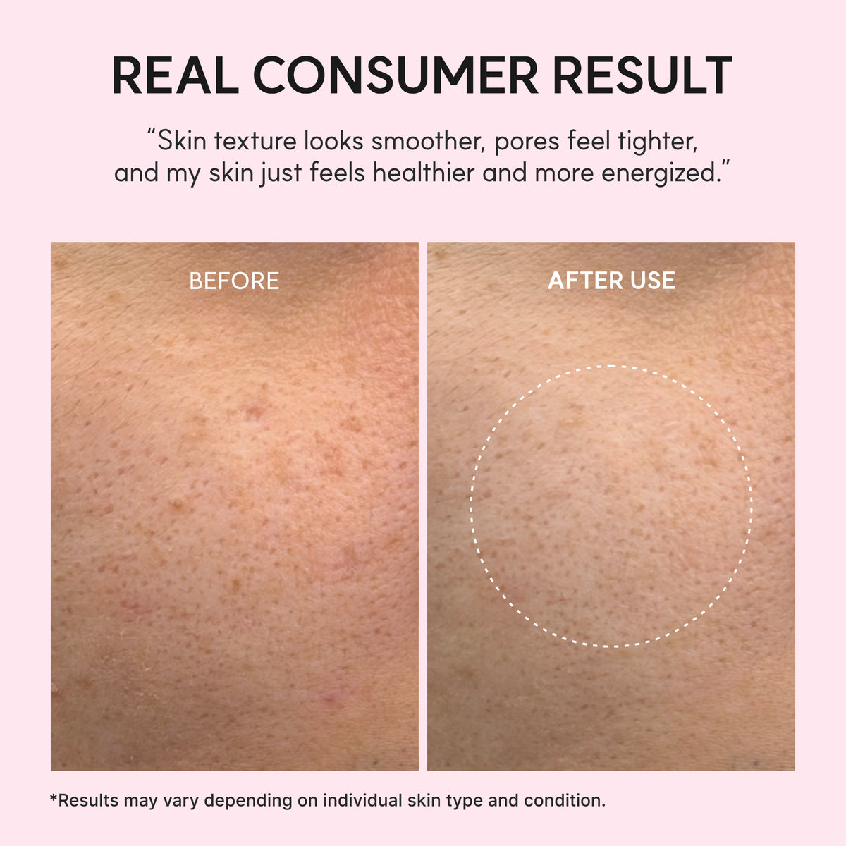 PDRN Booster Shot, Rosy-PDRN & Peptides for Glowy, Healthy Skin - Recommended for Sensitive, Red Skin 1.01 fl oz