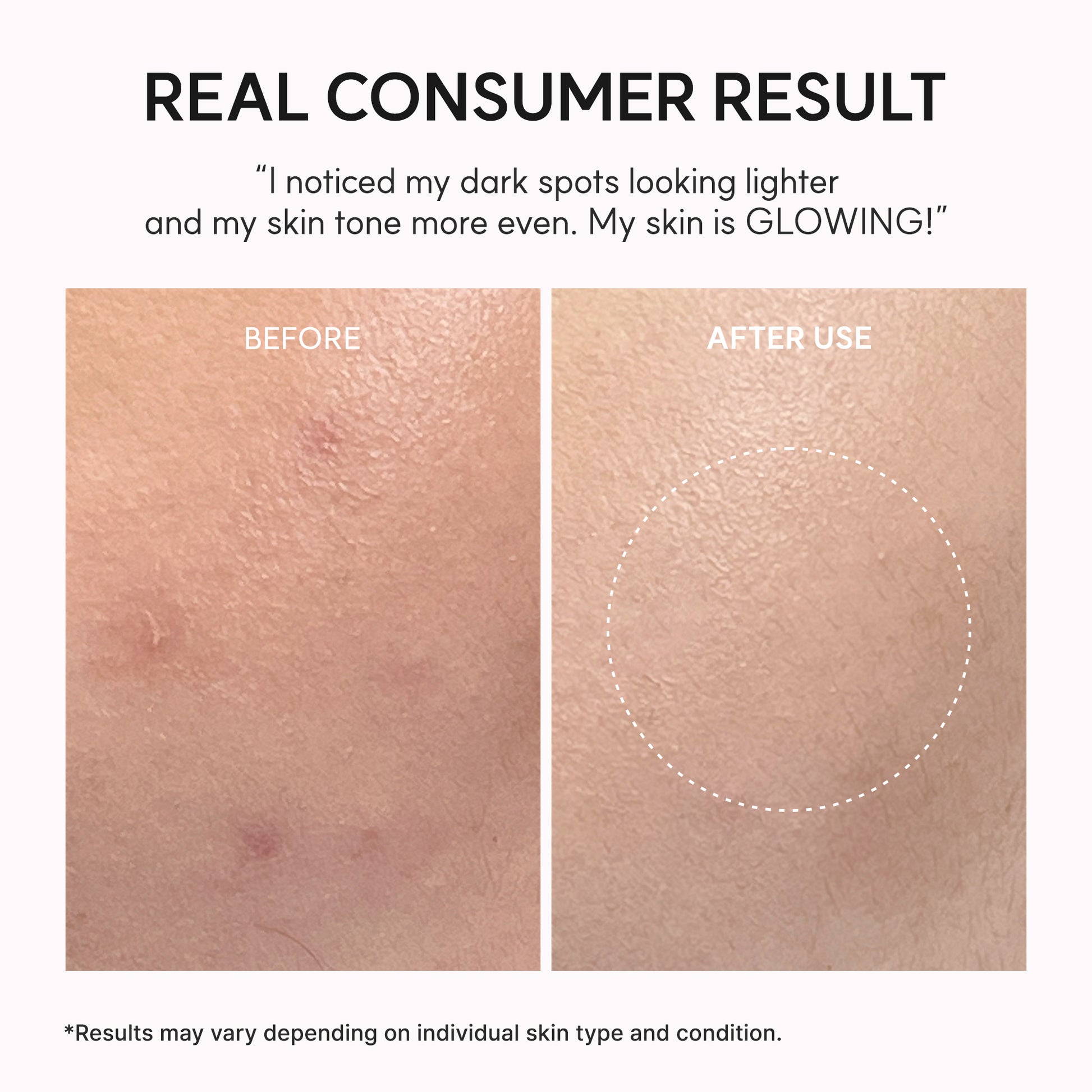 TXA Booster Shot, Intensive Dark Spot Correcting Serum with 5% TXA, Niacinamide & 10 Peptides for Visible Tone Correction & Radiant-Looking Skin, 1.01 fl. oz.