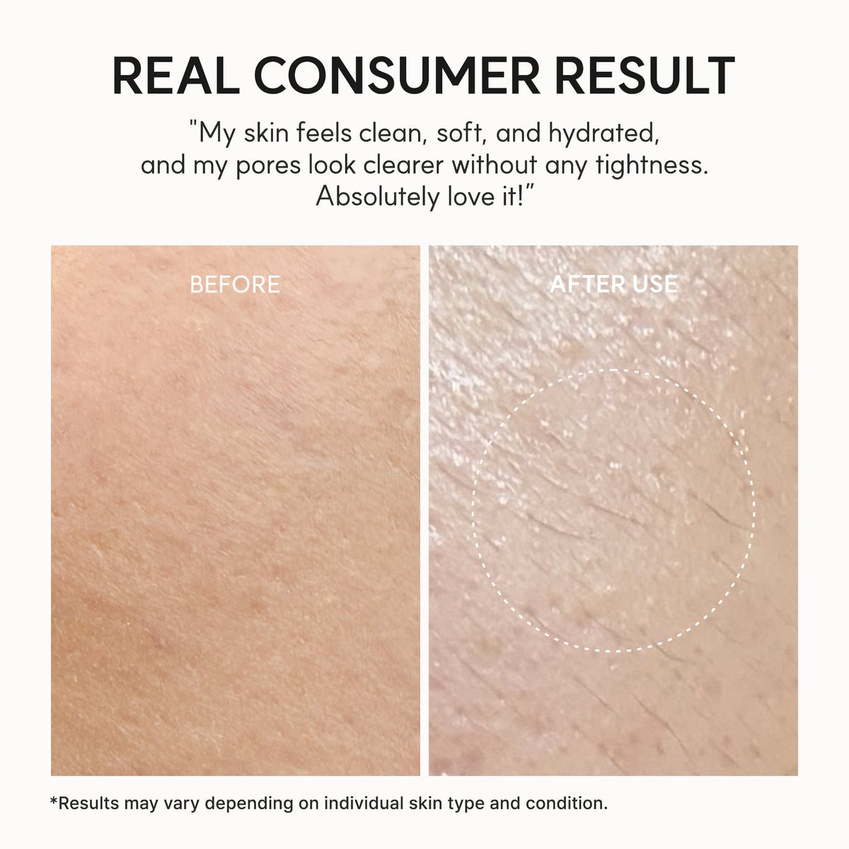 Arencia Fresh Rosehip Rice Mochi Cleanser