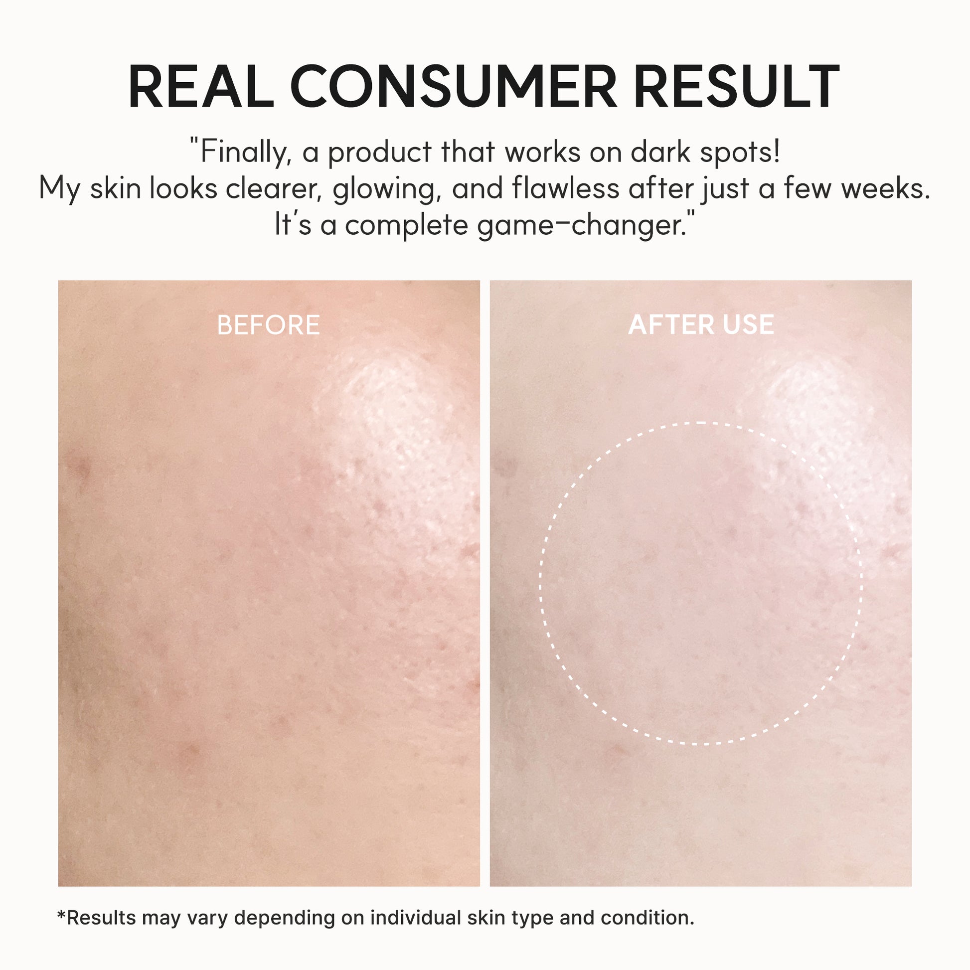 Vitamin C Glow Booster Gel Cream, Lightweight Brightening Gel Moisturizer for Even Tone & Radiant Skin, 1.76 oz