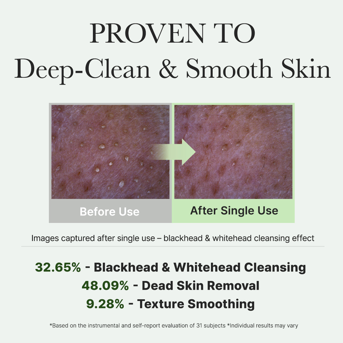 Arencia Fresh Green Mochi Cleanser, Gentle Daily Cleanser for Acne-Prone Skin, 1.76oz / 4.23oz