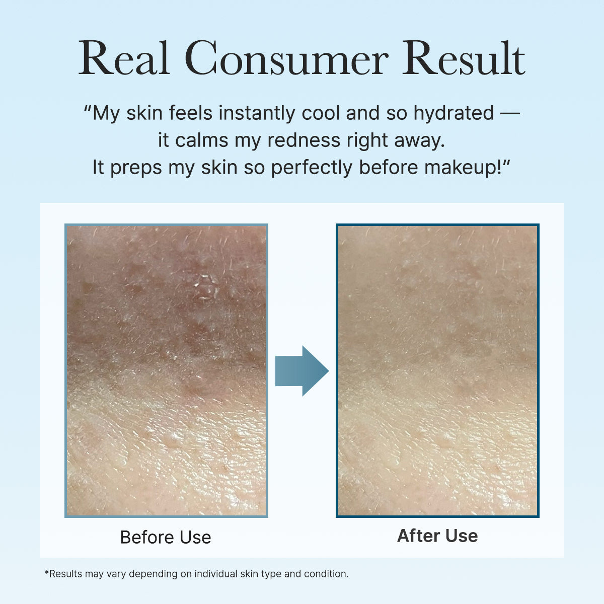 PDRN Hyaluronic Acid Deep Hydration Toner Pads, 6.76 fl. oz (90 Pads)