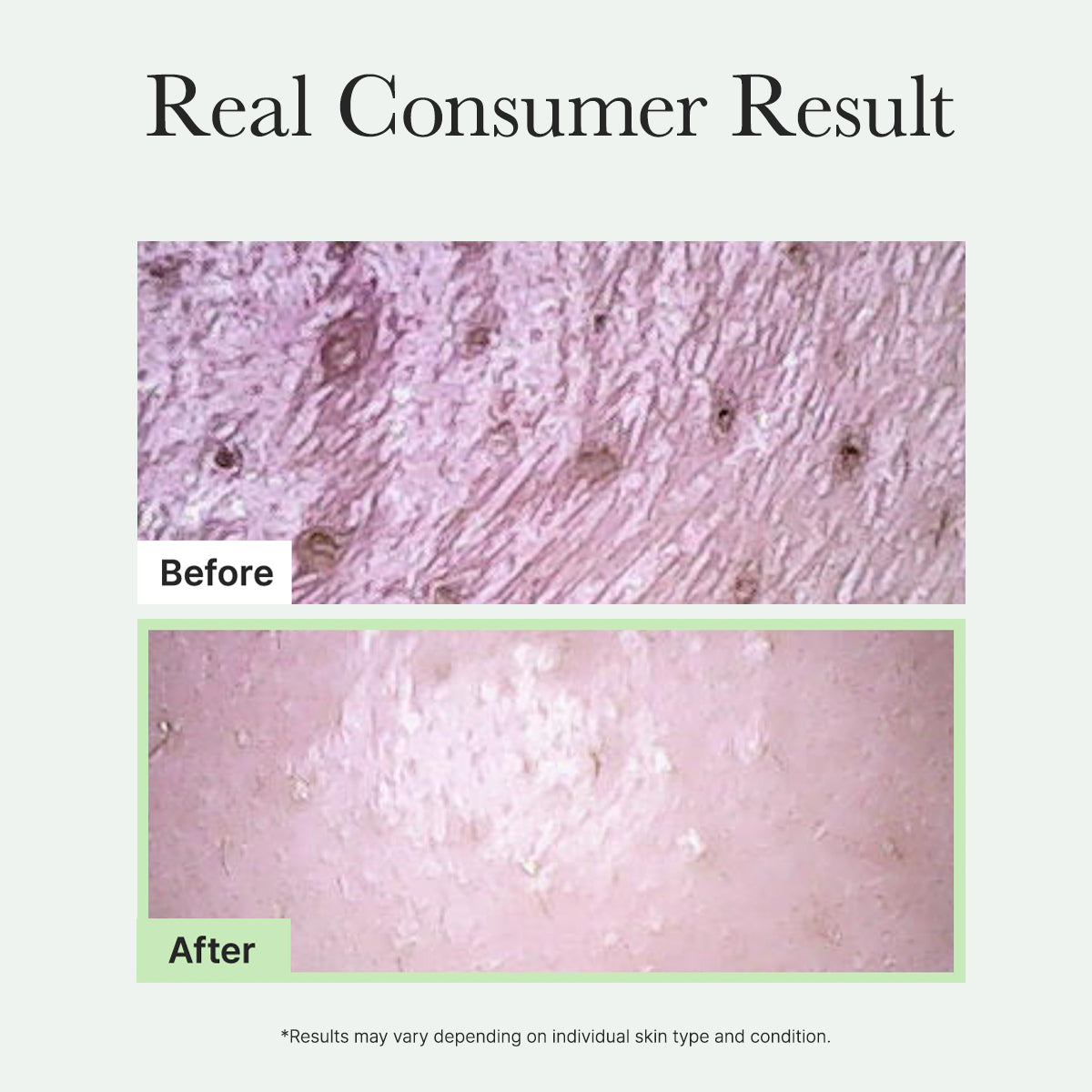 Arencia Fresh Green Mochi Cleanser, Gentle Daily Cleanser for Acne-Prone Skin, 1.76oz / 4.23oz