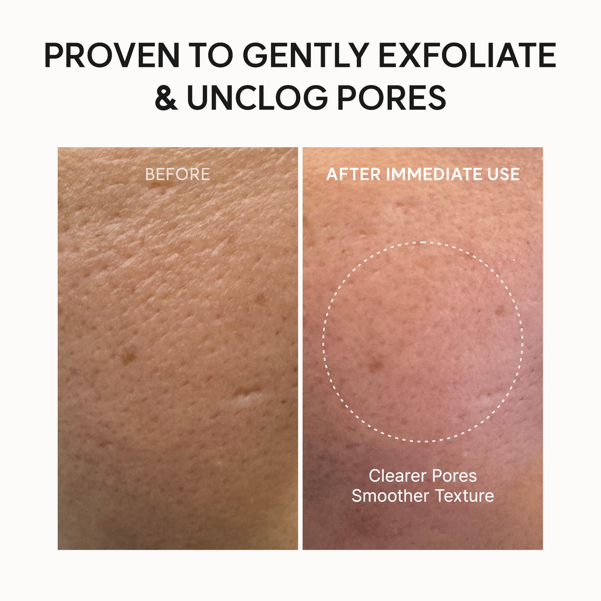 Arencia Fresh Green Rice Mochi Cleanser, Gentle Daily Cleanser for Acne-Prone Skin, 1.76oz / 4.23oz