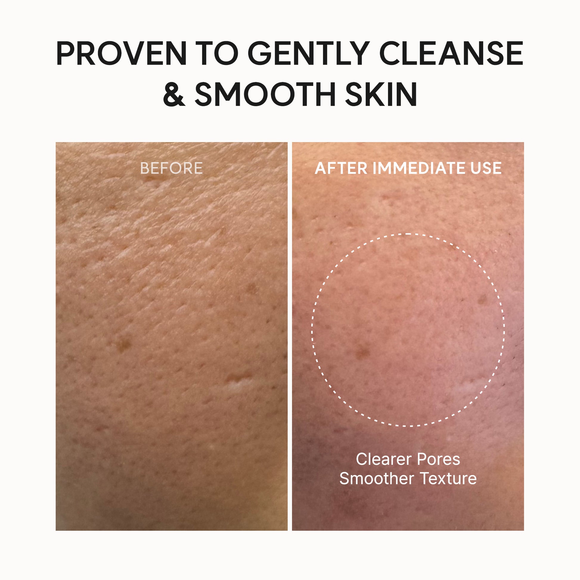 Arencia Fresh Rosehip Mochi Cleanser